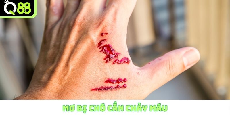 Mơ bị chó cắn chảy máu