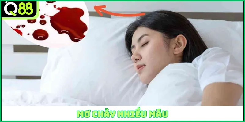Mơ chảy nhiều máu